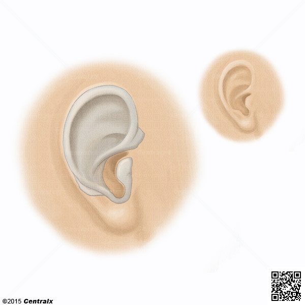 Cartlago Auricular