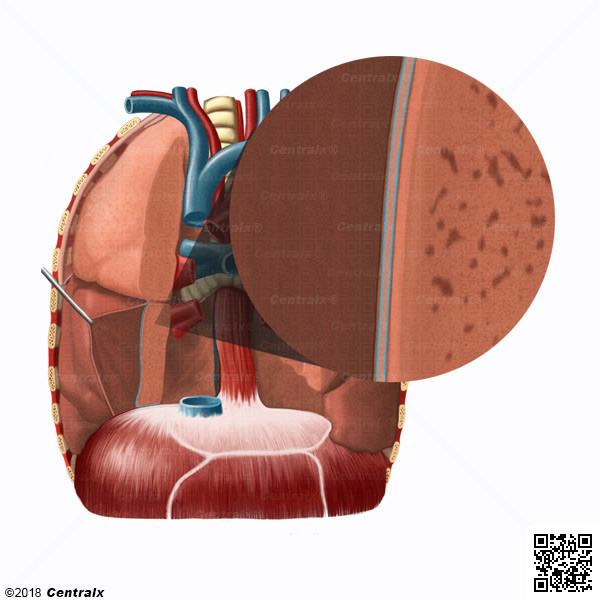 Cavidad Pleural