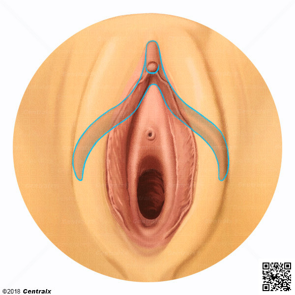 Cltoris