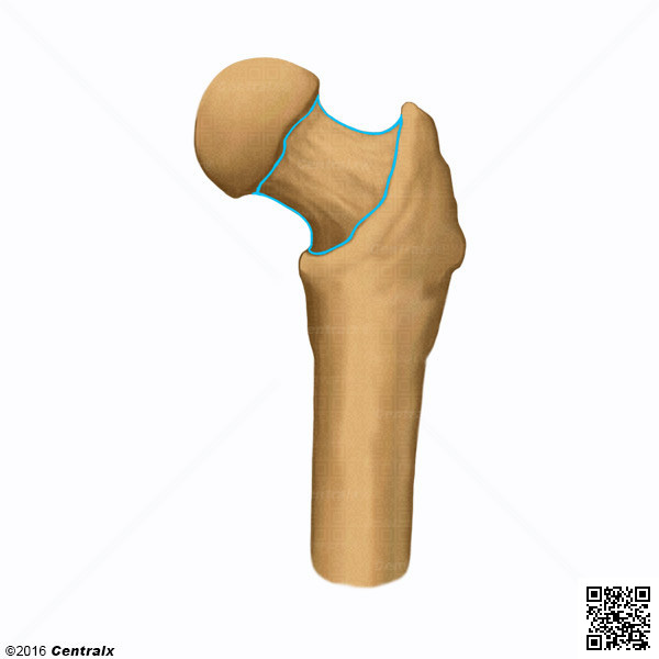 Cuello Femoral