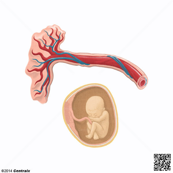 Arterias Umbilicales