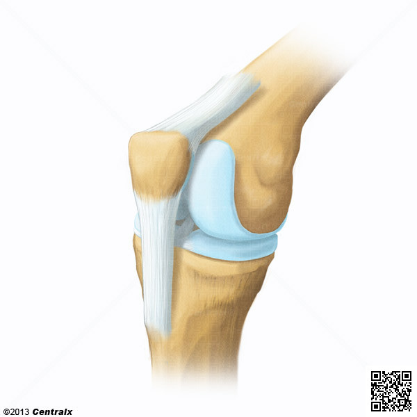 Ligamento Rotuliano