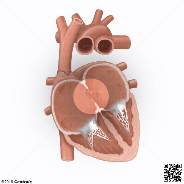 Foramen Oval