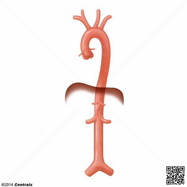 Aorta