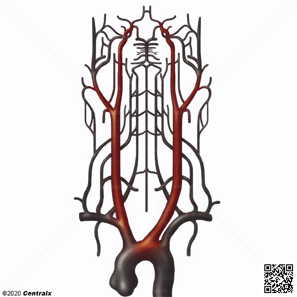 Arterias Cartidas