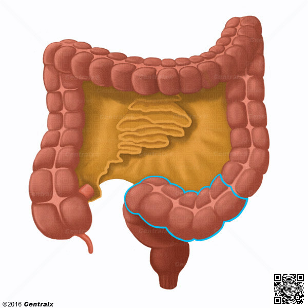 Colon Sigmoide