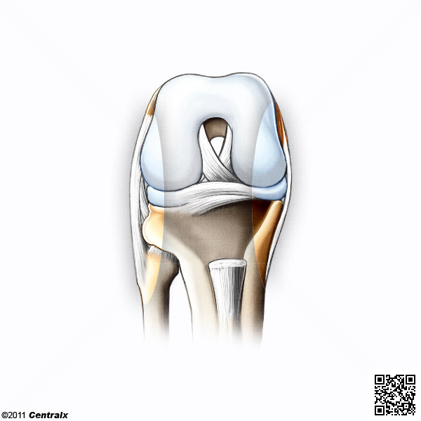 Ligamentos Colaterales