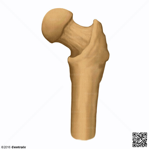 Cabeza Femoral