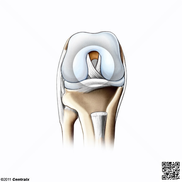 Ligamento Cruzado Anterior