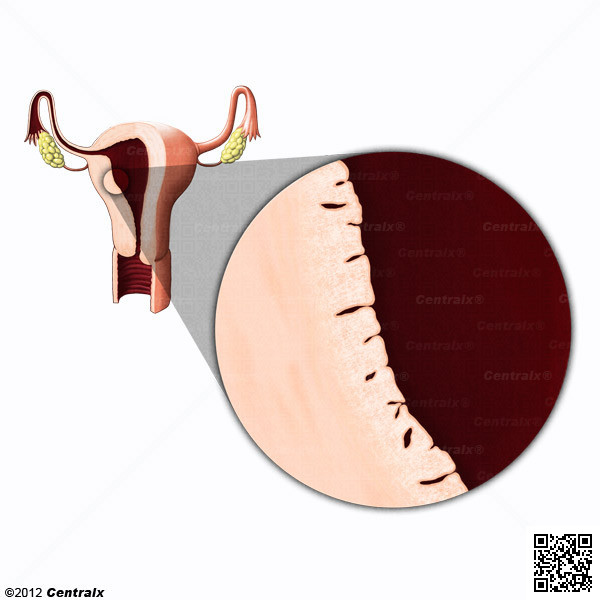 Endometrio