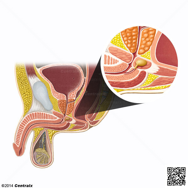 Glndulas Bulbouretrales