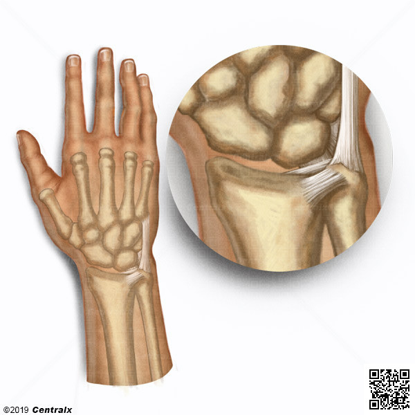 Fibrocartlago Triangular