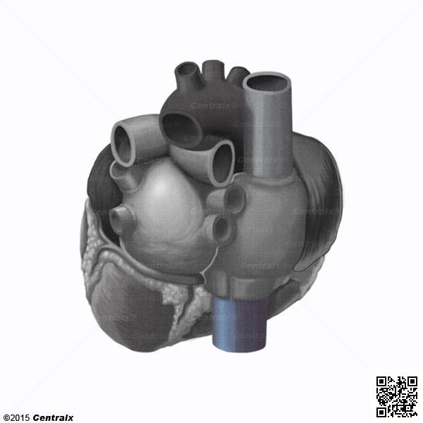 Vena Cava Inferior