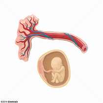 Arterias Umbilicales