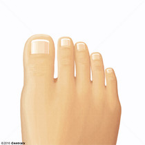 Dedos del Pie