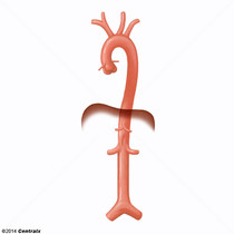 Aorta