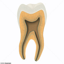 Dentina Secundaria